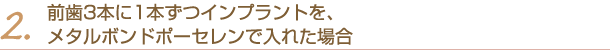 2.前歯3本に1本ずつインプラントを、メタルボンドポーセレンで入れた場合